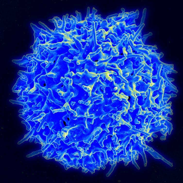 A scanning electron microscope image of blue lumpy sphere of a T cell.