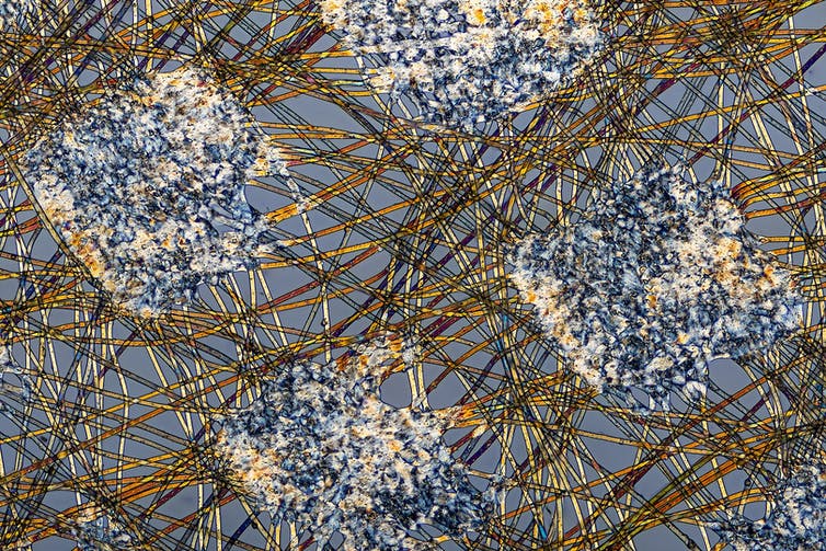A tangled mass of fibers, as seen through a microscope.
