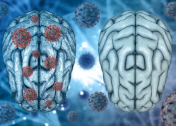 Even mild cases of COVID-19 can leave a mark on the brain, such as reductions in gray matter – a neuroscientist explains emerging research