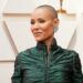 What is alopecia? It’s no laughing matter for millions of Black American women