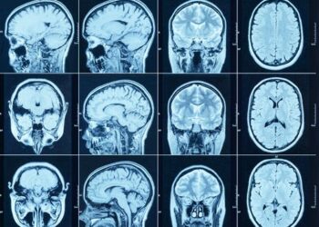 Brain charts: first comprehensive view of how the brain changes over a lifetime