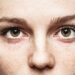 What your eyes reveal about your health