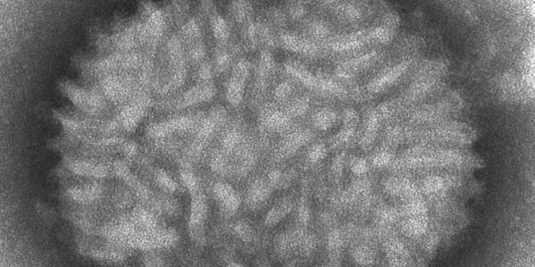 Monkeypox: some countries are protecting contacts with the smallpox vaccine, which uses humanity’s only domesticated virus