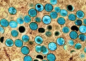 Monkeypox FAQ: How is it transmitted? Where did it come from? What are the symptoms? Does smallpox vaccine prevent it?