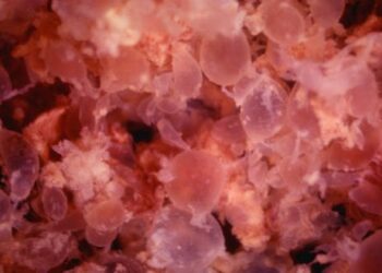 What is ectopic pregnancy? A reproductive health expert explains