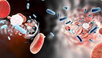 Sepsis still kills 1 in 5 people worldwide – two ICU physicians offer a new approach to stopping it