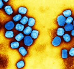 Bright blue rectangular virus particles against a yellow background