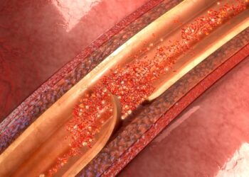 Depeche Mode keyboardist Andrew Fletcher died of an aortic dissection – here’s what it is