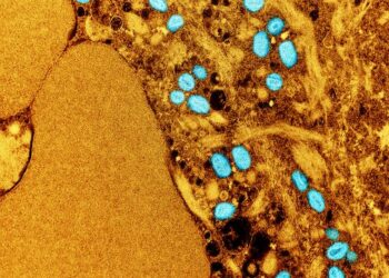 Treating monkeypox like an STI may help control the outbreak, but stigma is a danger