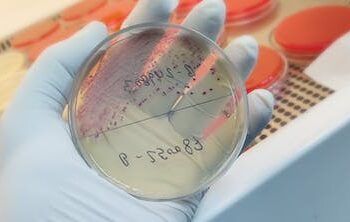 UTIs are still diagnosed using a 140-year-old method – here’s why