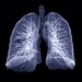 COVID-19 can cause lasting lung damage – 3 ways long COVID patients’ respiration can suffer