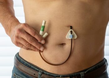 Parkinson’s disease: treatment is best started early