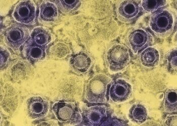 Do viruses play a role in the development of Alzheimer’s? Uncharted Brain podcast part 3