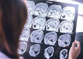 Another Alzheimer’s drug fails in late-stage trials – what now?