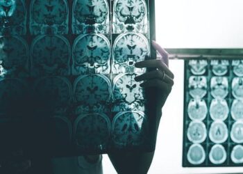 Alzheimer’s: blood biomarker may help identify the disease ten years before symptoms start