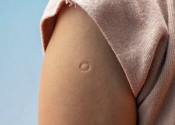 BCG: how a century-old vaccine is being used against everything from cancer to autoimmune diseases