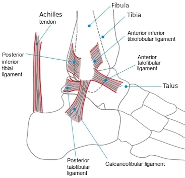 A diagram of a human ankle.