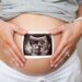 Surrogacy shake up in UK would create uneven treatment for birth mothers