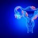 Endometriosis: how the condition may be linked to the immune system