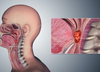 Oral sex is now the leading risk factor for throat cancer
