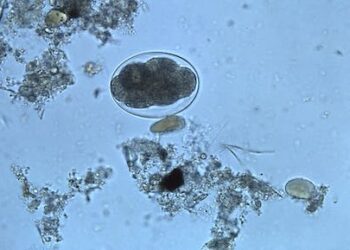 Parasitic infections hit the health of low-income Black communities where states have neglected sewage systems