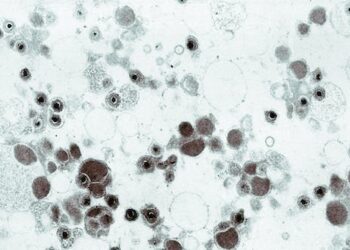 Cytomegalovirus lies dormant in most US adults and is the leading infectious cause of birth defects, but few have heard of it