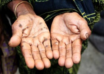 Arsenic contamination of food and water is a global public health concern – researchers are studying how it causes cancer