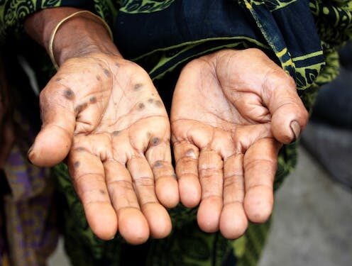 Arsenic contamination of food and water is a global public health concern – researchers are studying how it causes cancer