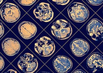 Microbiome: certain gut microbes may warn of Alzheimer’s disease long before the first symptoms begin