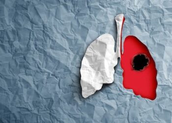 How England’s new lung cancer screening could save thousands of lives – expert Q&A