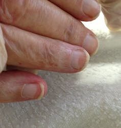 What your hands say about your health