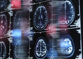 Alzheimer’s disease is partly genetic − studying the genes that delay decline in some may lead to treatments for all