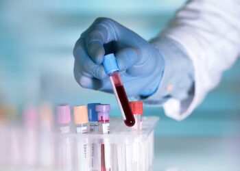 Alzheimer’s disease blood tests: here’s what they look for, and what they can tell you about your risk