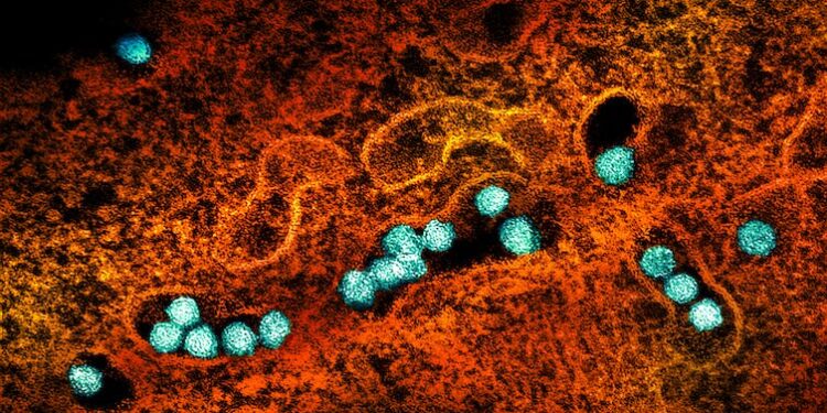 What Canadians need to know about West Nile virus, a mosquito-borne infection that can be life-threatening