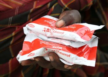 Wasting and edema — severe forms of malnutrition — affect millions of children worldwide as food insecurity grows