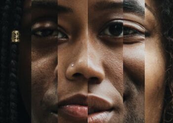 Racism produces subtle brain changes that lead to increased disease risk in Black populations