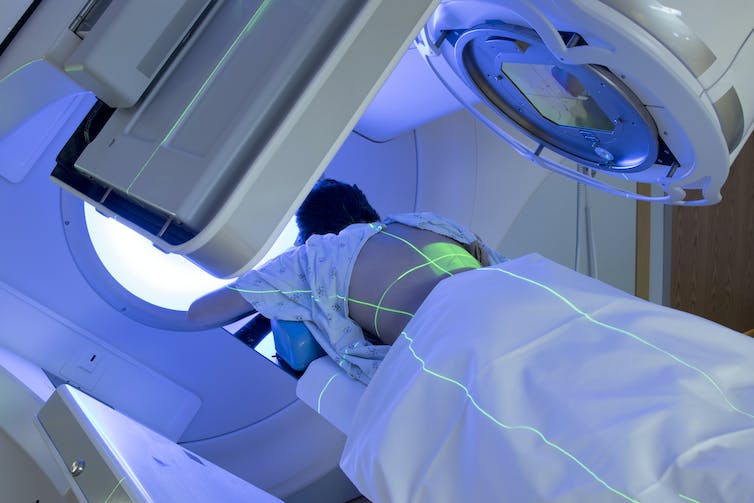 Patient laying on stomach in a radiotherapy machine, green lasers crisscrossed over their exposed back