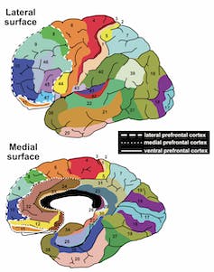 A map of different areas of the brain