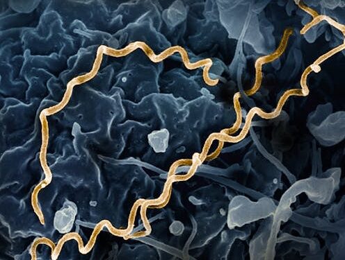 FAQ: Why are syphilis cases on the rise in Canada?
