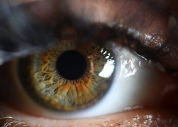 Are you one of the millions about to have cataract surgery? Here’s what ophthalmologists say you need to know