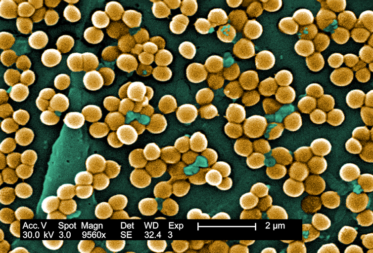 Microscopy image of clusters of spherical bacteria stained yellow against a green background