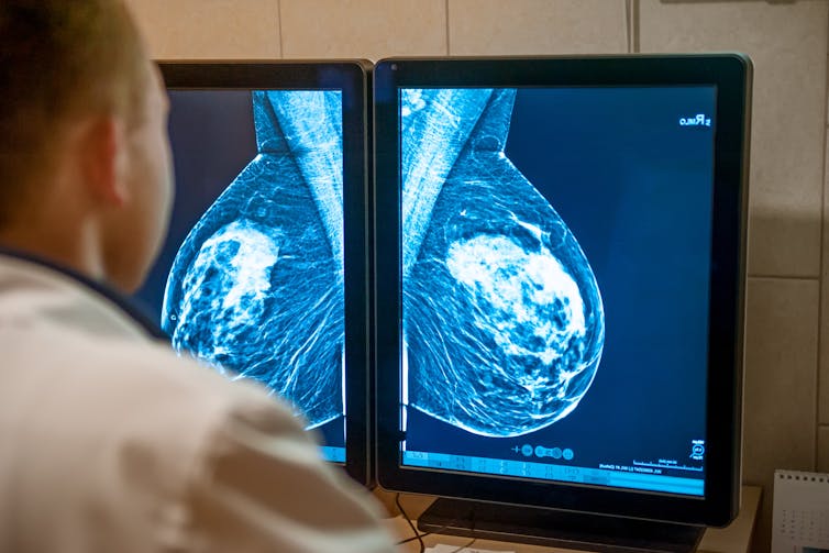A health-care worker seen from behind looking at mammography images on a screen