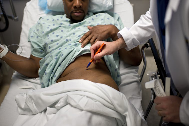 A black man raises his gown as a doctor uses a marker to  show which kidney is to be removed during surgery.