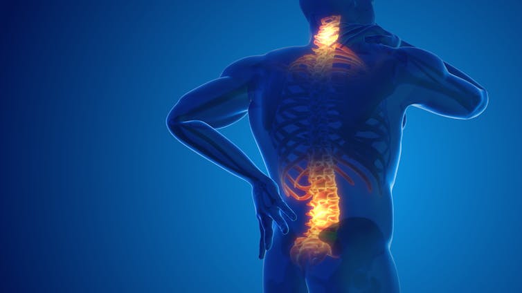 Three-dimensional illustration of pain in the back and neck, with painful areas lit up against a dark background.