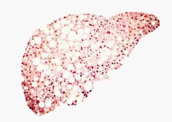 Diabetes and obesity can damage the liver to the point of failure – but few people know their risk of developing liver disease