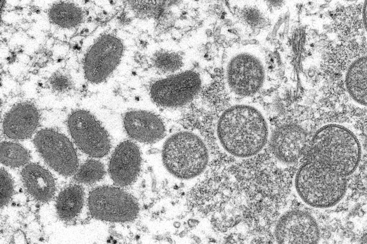 Electron microscope view of monkeypox virus, showing oval-shaped, mature virus particles and spherical, immature virions