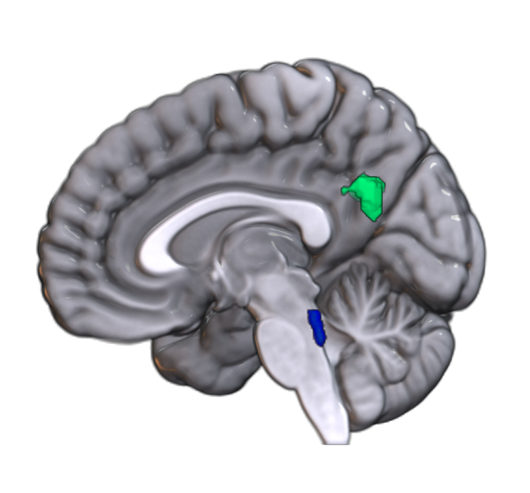 Graphic illustration of a brain with locus coeruleus highlighted in blude and precuneus region highlighted in green.