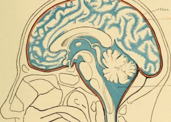 Fluid keeps your brain from crushing itself and shields your spine from shock – a neurologist explains what happens when it stops working