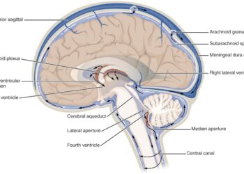 Fluid keeps your brain from crushing itself and shields your spine from shock – a neurologist explains what happens when it stops working