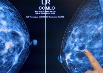 FDA’s new regulations underscore the complexity around screening for women with dense breasts